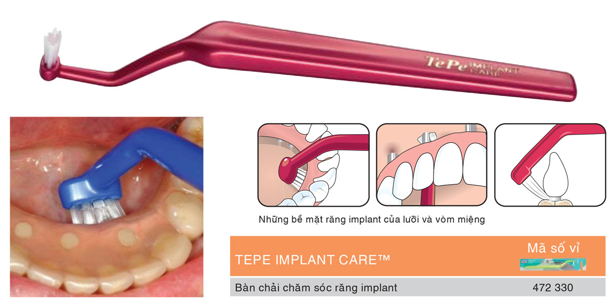 Bàn chải đánh răng đầu vòm dùng cho răng implant Tepe Implant Care