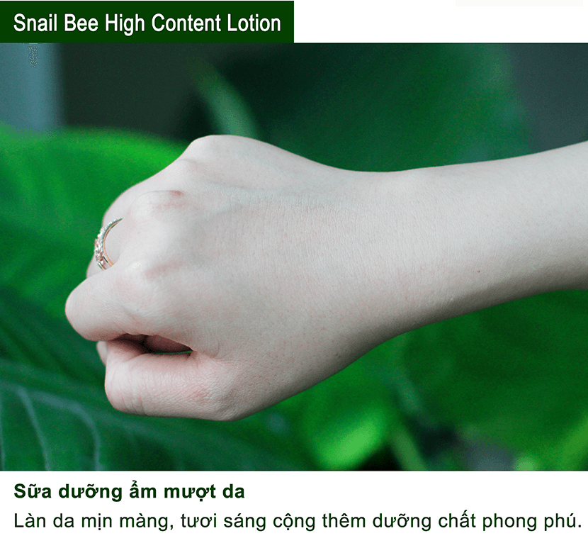 Sữa dưỡng da trị mụn Benton Snail Bee High Content Lotion 120ml