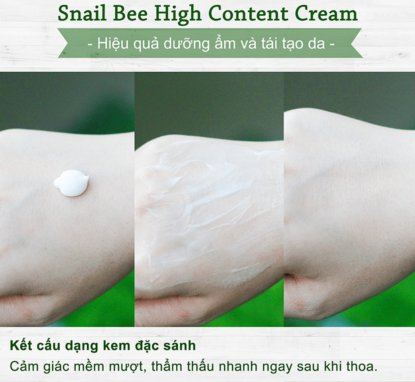 Kem dưỡng da trị mụn Benton Snail Bee High Content Steam Cream 50g