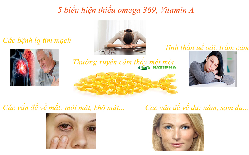 Thực phẩm chức năng Omega 3-6-9 bổ não, tăng trí nhớ, sáng mắt.