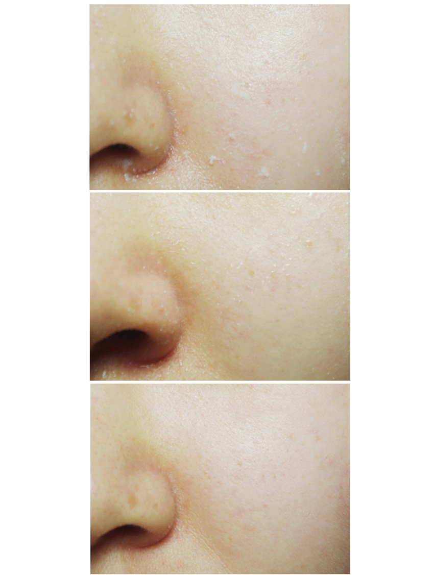 Gel rửa mặt tẩy tế bào chết loại bỏ mụn đầu đen, kiểm soát nhờn Ciracle Pore Control Daily Wash Peeling Gel 100ml
