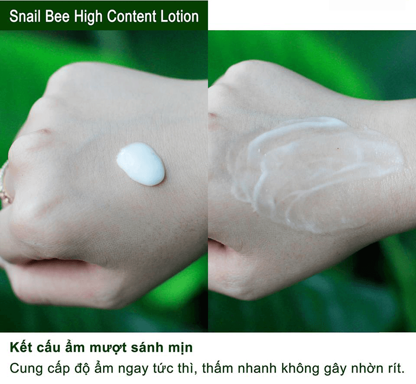 Sữa dưỡng da trị mụn Benton Snail Bee High Content Lotion 120ml