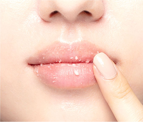 Tẩy Tế Bào Chết Cho Môi Innisfree Lip Peeling Booster (15ml)